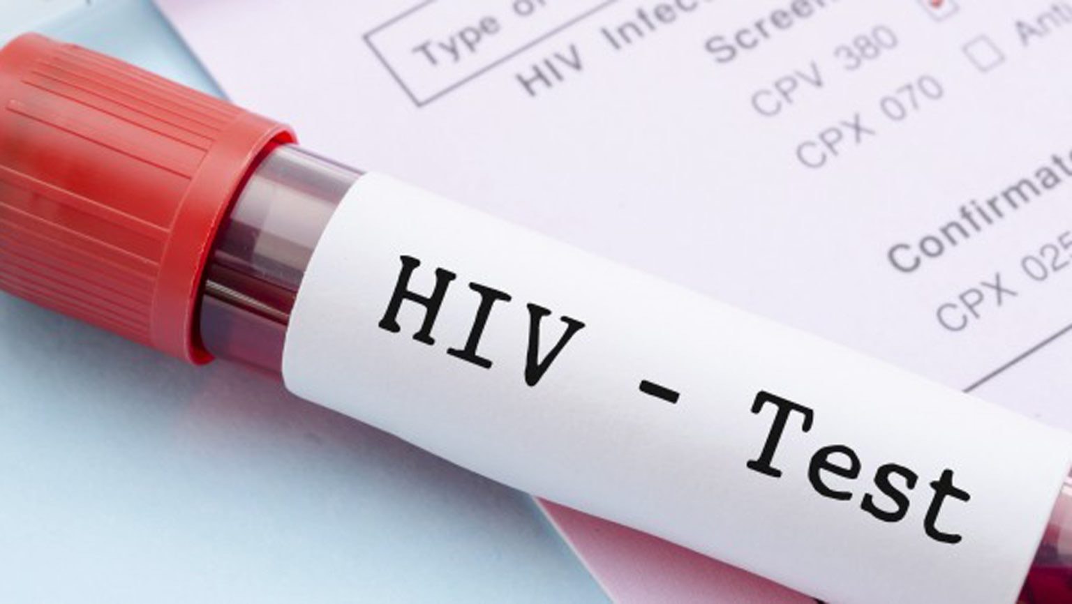 HIV