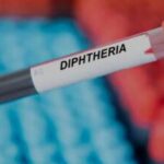 Diphtheria