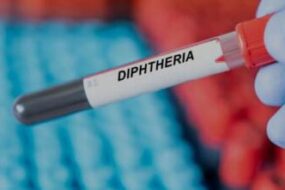 Diphtheria